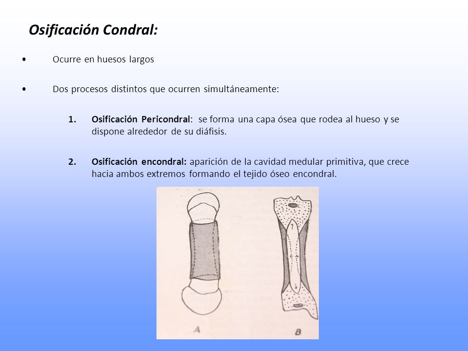 Osificación Condral: Ocurre en huesos largos