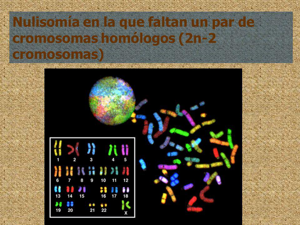 Nulisomía en la que faltan un par de cromosomas homólogos (2n-2 cromosomas)