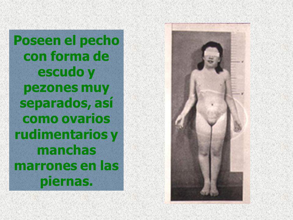 Poseen el pecho con forma de escudo y pezones muy separados, así como ovarios rudimentarios y manchas marrones en las piernas.