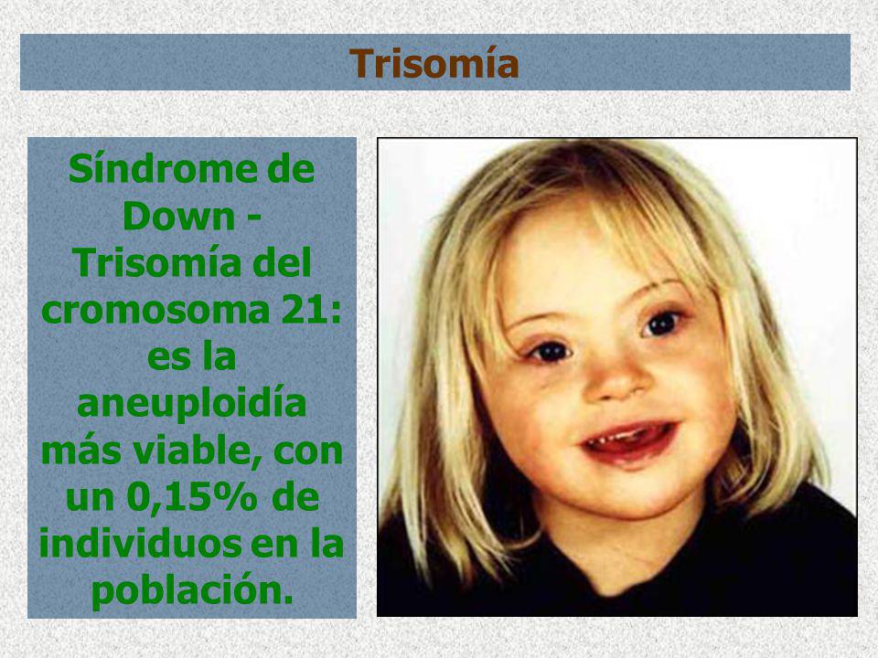 Trisomía Síndrome de Down - Trisomía del cromosoma 21: es la aneuploidía más viable, con un 0,15% de individuos en la población.