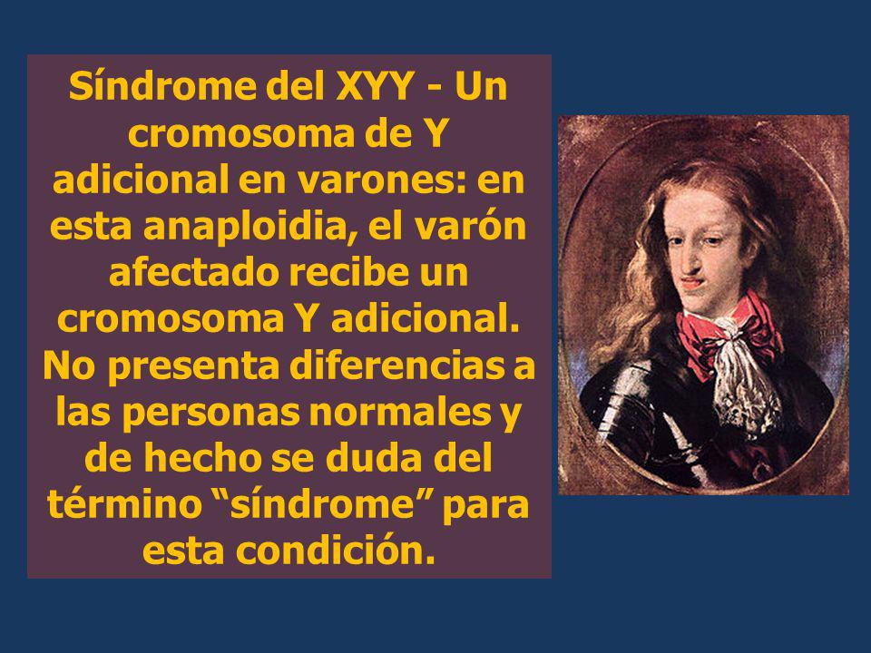 Síndrome del XYY - Un cromosoma de Y adicional en varones: en esta anaploidia, el varón afectado recibe un cromosoma Y adicional.