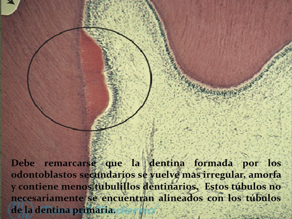 Debe remarcarse que la dentina formada por los odontoblastos secundarios se vuelve mas irregular, amorfa y contiene menos tubulillos dentinarios.