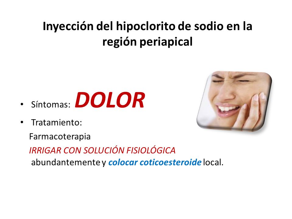 Inyección del hipoclorito de sodio en la región periapical