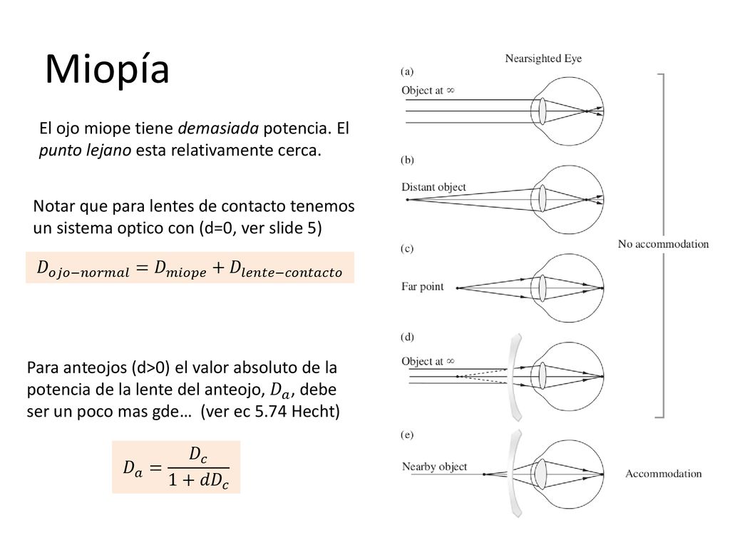 Miopía El ojo miope tiene demasiada potencia. El punto lejano esta relativamente cerca. 𝐷 𝑜𝑗𝑜−𝑛𝑜𝑟𝑚𝑎𝑙 = 𝐷 𝑚𝑖𝑜𝑝𝑒 +𝐷 𝑙𝑒𝑛𝑡𝑒−𝑐𝑜𝑛𝑡𝑎𝑐𝑡𝑜.