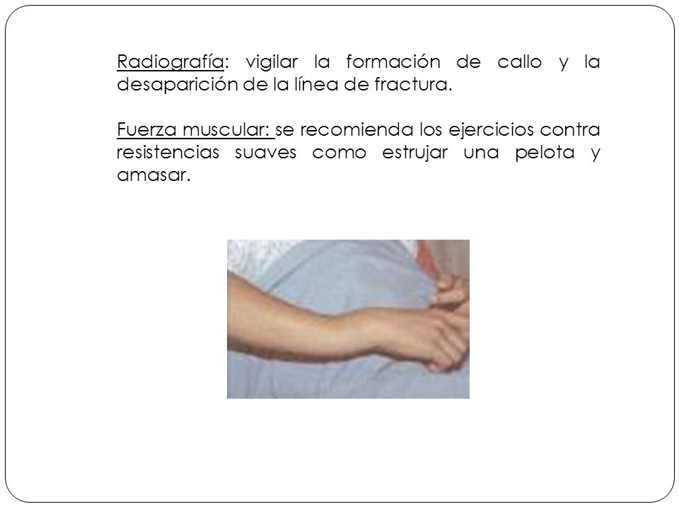 Radiografía: vigilar la formación de callo y la desaparición de la línea de fractura.