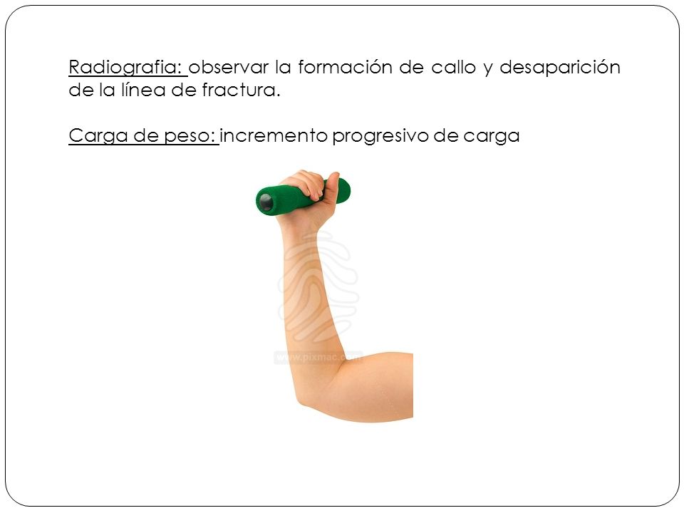 Radiografia: observar la formación de callo y desaparición de la línea de fractura.
