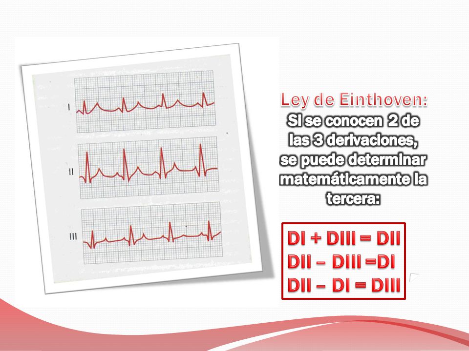Ley de Einthoven: DI + DIII = DII DII – DIII =DI DII – DI = DIII