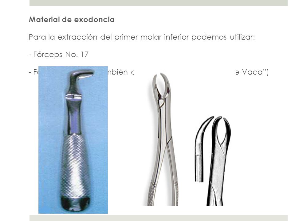 Material de exodoncia Para la extracción del primer molar inferior podemos utilizar: - Fórceps No.