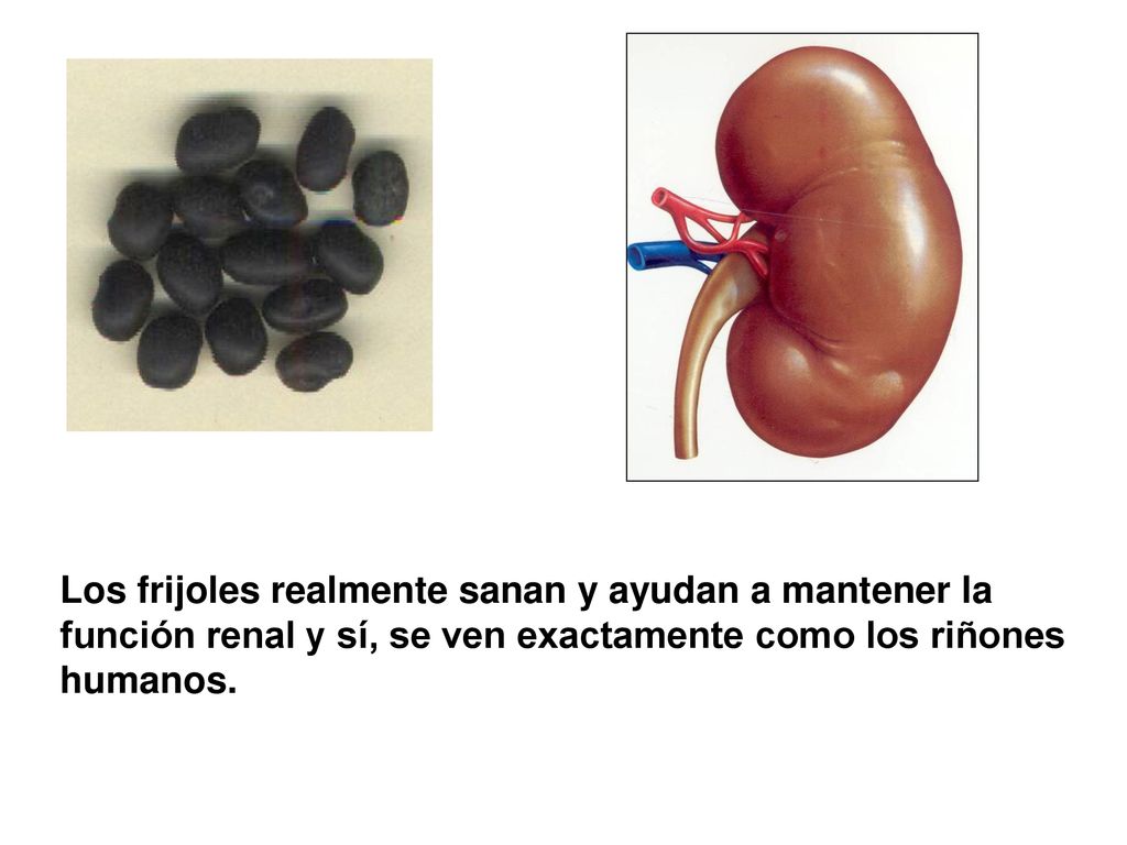 Los frijoles realmente sanan y ayudan a mantener la función renal y sí, se ven exactamente como los riñones humanos.