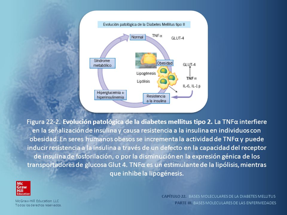 Figura Evolución patológica de la diabetes mellitus tipo 2