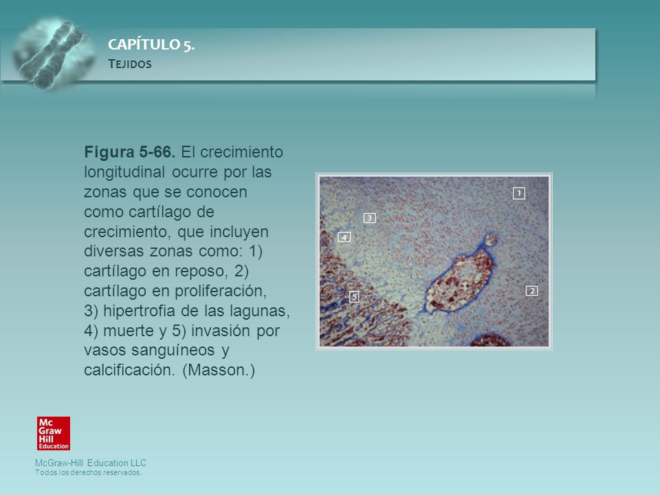 Figura El crecimiento longitudinal ocurre por las zonas que se conocen como cartílago de crecimiento, que incluyen diversas zonas como: 1) cartílago en reposo, 2) cartílago en proliferación,
