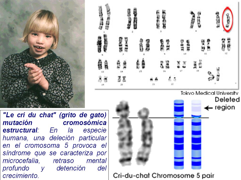 Le cri du chat (grito de gato) mutación cromosómica estructural: En la especie humana, una deleción particular en el cromosoma 5 provoca el síndrome que se caracteriza por microcefalia, retraso mental profundo y detención del crecimiento.