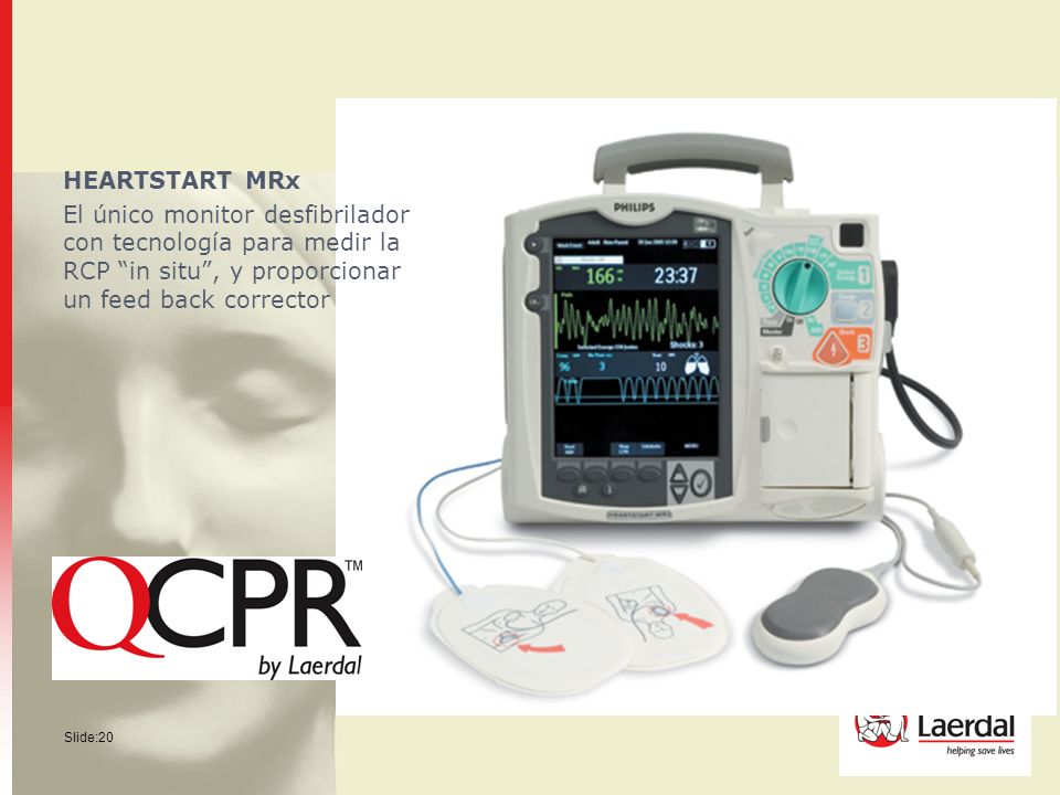 HEARTSTART MRx El único monitor desfibrilador con tecnología para medir la RCP in situ , y proporcionar un feed back corrector.