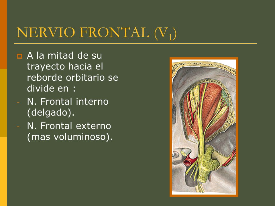 NERVIO FRONTAL (V1) A la mitad de su trayecto hacia el reborde orbitario se divide en : N. Frontal interno (delgado).