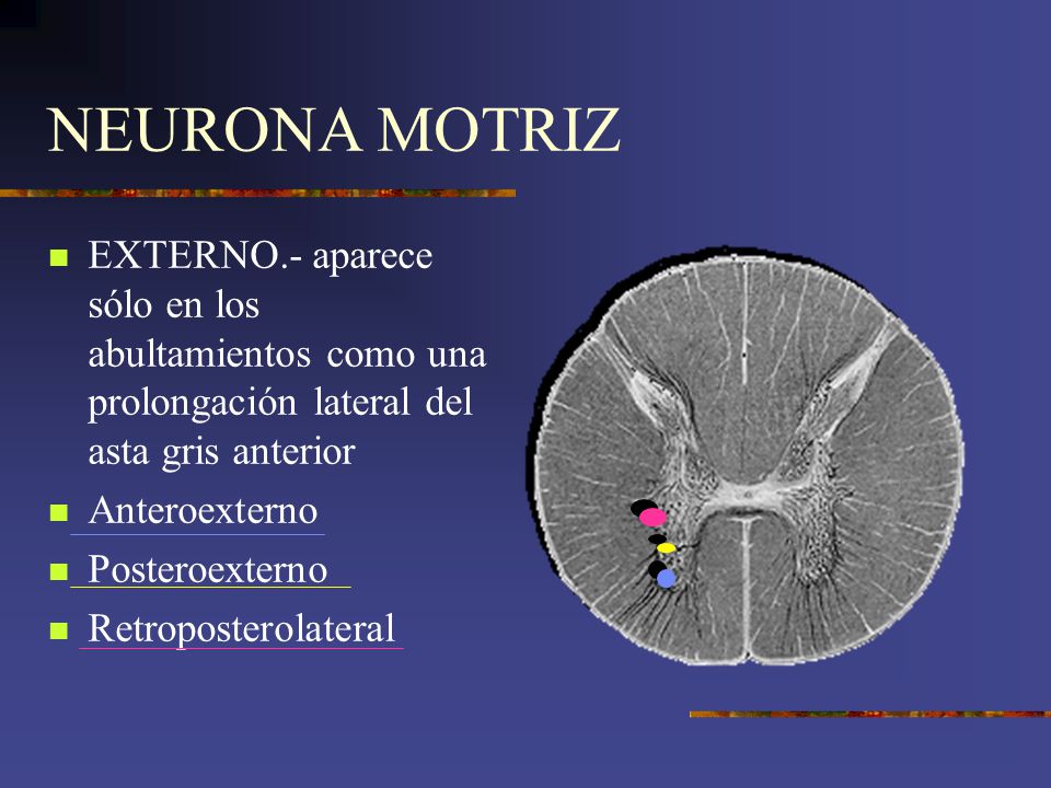 NEURONA MOTRIZ EXTERNO.- aparece sólo en los abultamientos como una prolongación lateral del asta gris anterior.