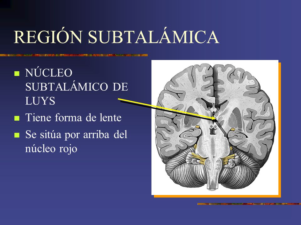 REGIÓN SUBTALÁMICA NÚCLEO SUBTALÁMICO DE LUYS Tiene forma de lente