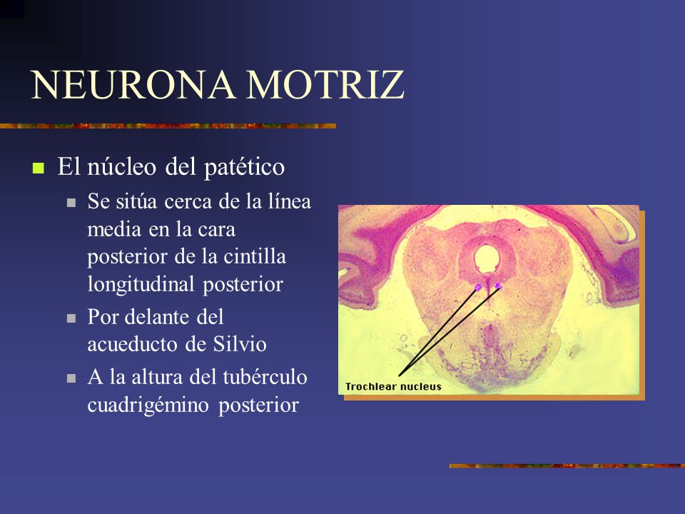 NEURONA MOTRIZ El núcleo del patético