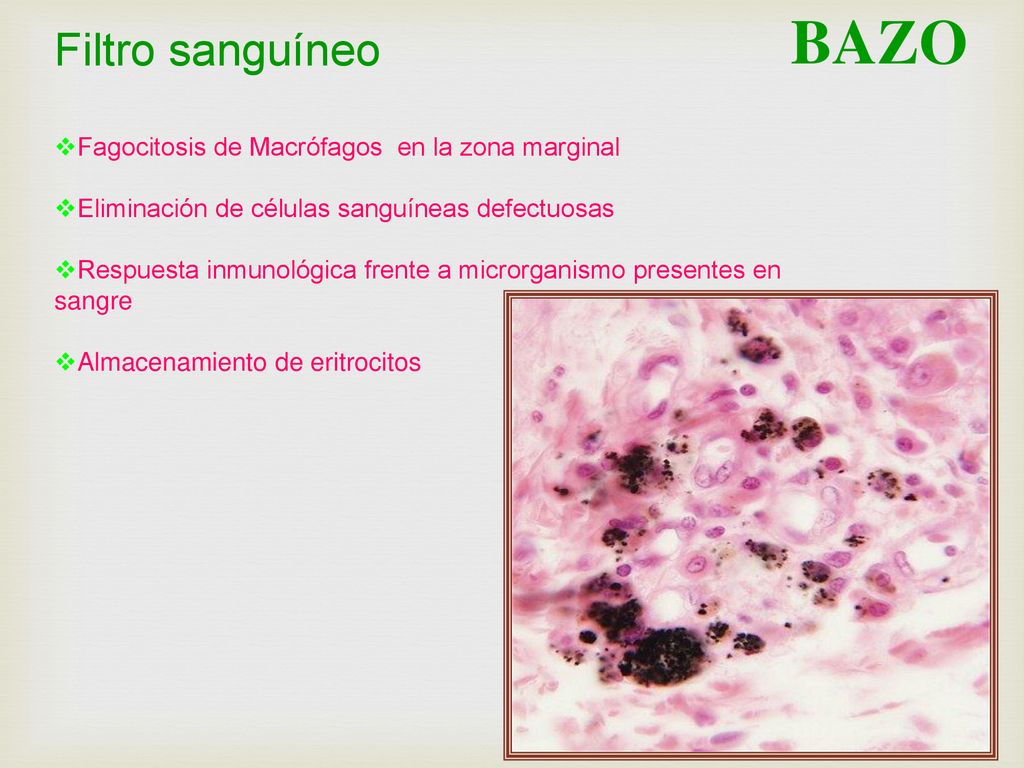 BAZO Filtro sanguíneo Fagocitosis de Macrófagos en la zona marginal