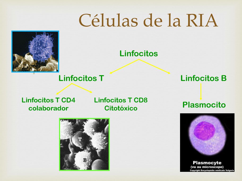 Células de la RIA Linfocitos Linfocitos T Linfocitos B Plasmocito