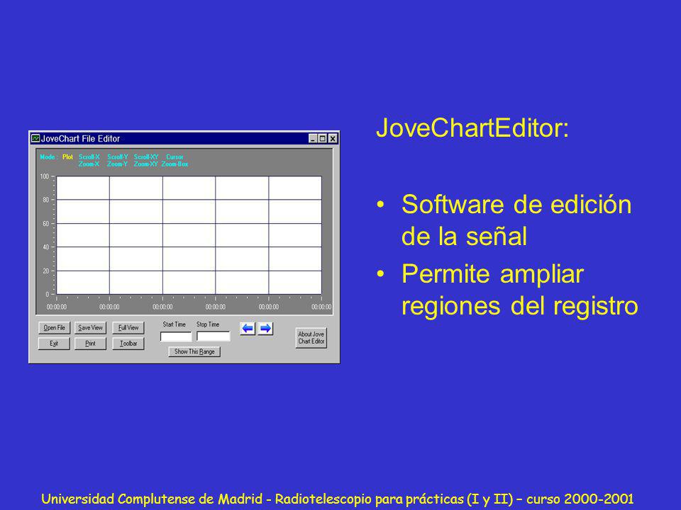 Software de edición de la señal Permite ampliar regiones del registro