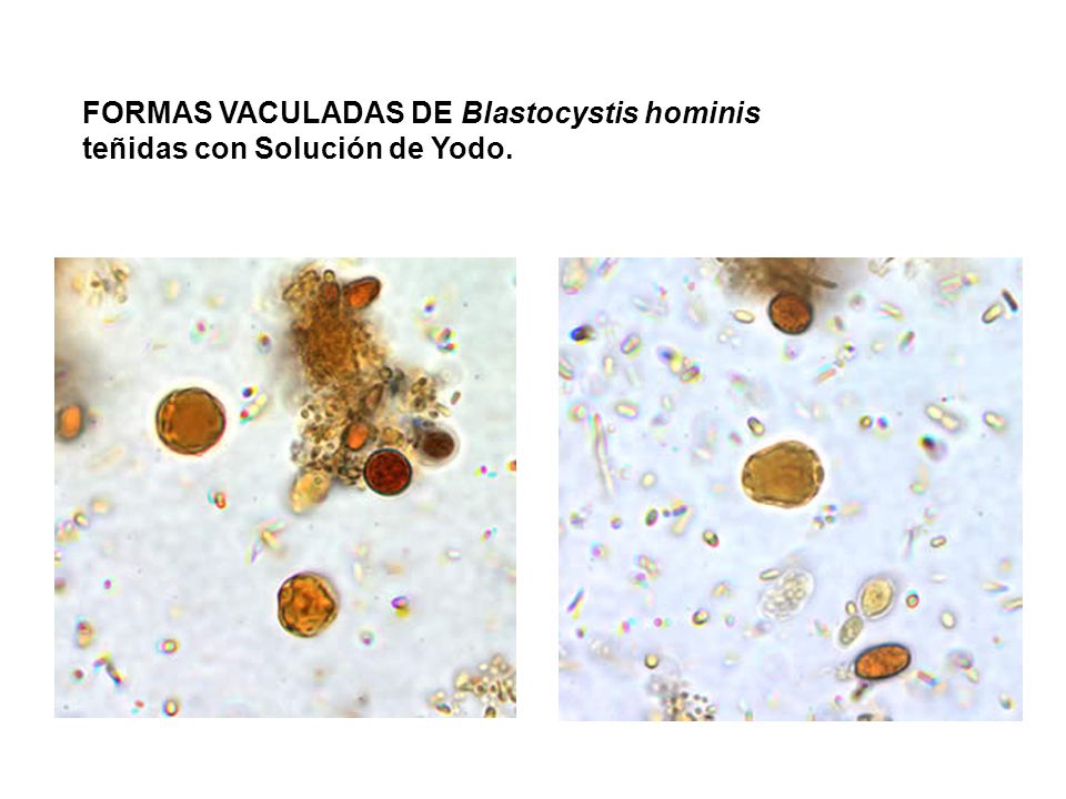 Простейшие в кале лечение. Цисты лямблий микроскопия кала. Цисты бластоцисты хоминис 2~3. Blastocystis Hominis трофозоиты.