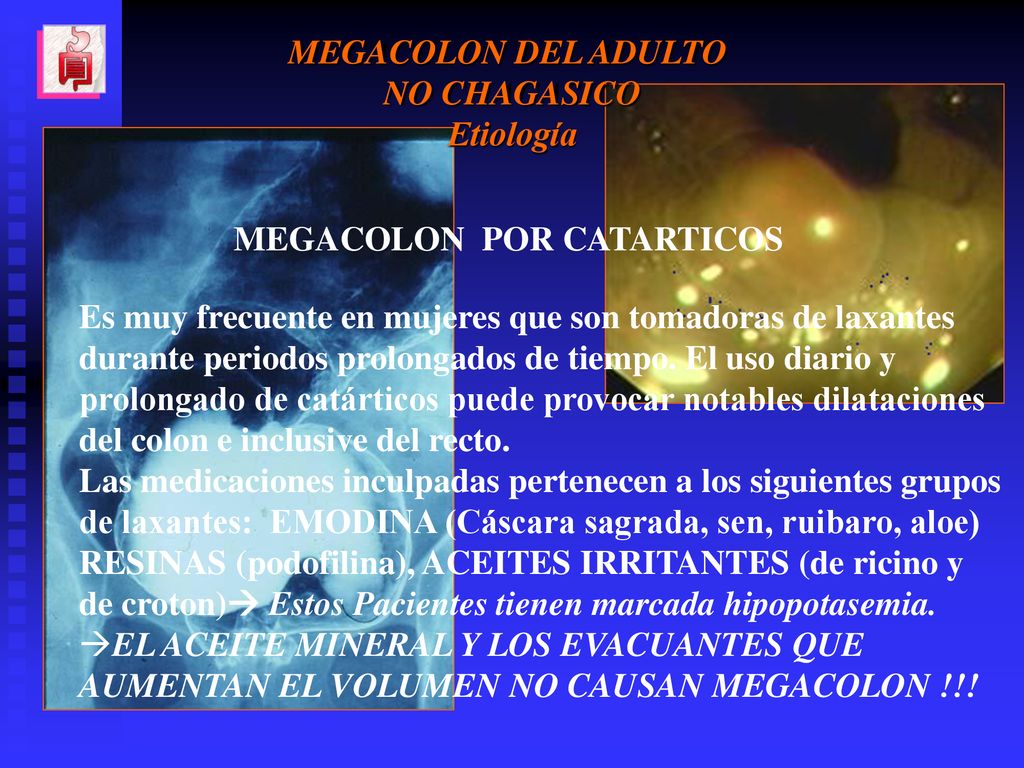 MEGACOLON DEL ADULTO NO CHAGASICO. Etiología. MEGACOLON POR CATARTICOS. Es muy frecuente en mujeres que son tomadoras de laxantes.