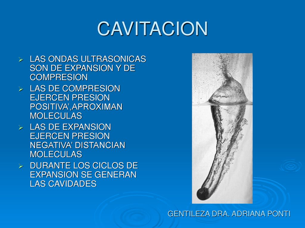 CAVITACION LAS ONDAS ULTRASONICAS SON DE EXPANSION Y DE COMPRESION