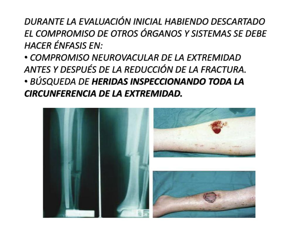 DURANTE LA EVALUACIÓN INICIAL HABIENDO DESCARTADO EL COMPROMISO DE OTROS ÓRGANOS Y SISTEMAS SE DEBE HACER ÉNFASIS EN: