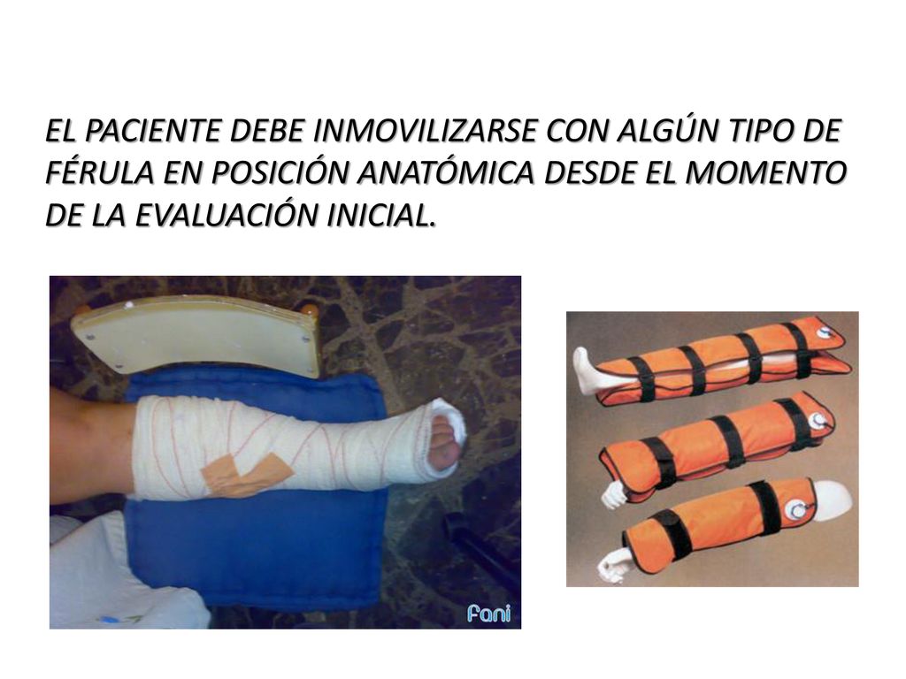 EL PACIENTE DEBE INMOVILIZARSE CON ALGÚN TIPO DE FÉRULA EN POSICIÓN ANATÓMICA DESDE EL MOMENTO DE LA EVALUACIÓN INICIAL.