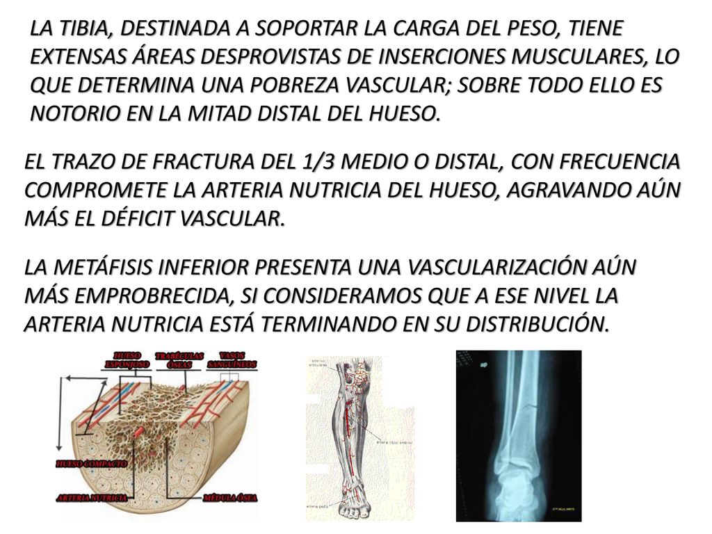LA TIBIA, DESTINADA A SOPORTAR LA CARGA DEL PESO, TIENE EXTENSAS ÁREAS DESPROVISTAS DE INSERCIONES MUSCULARES, LO QUE DETERMINA UNA POBREZA VASCULAR; SOBRE TODO ELLO ES NOTORIO EN LA MITAD DISTAL DEL HUESO.