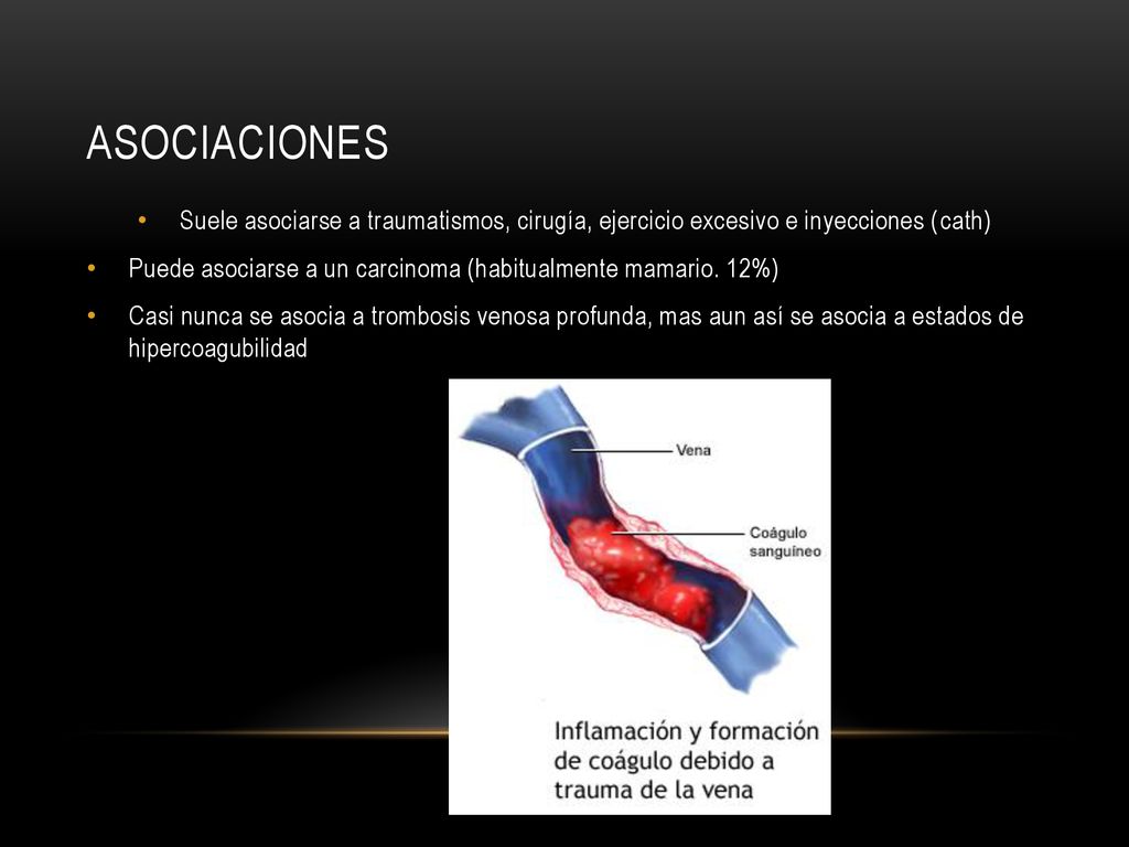 Asociaciones Suele asociarse a traumatismos, cirugía, ejercicio excesivo e inyecciones (cath)