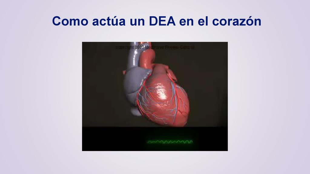 Como actúa un DEA en el corazón