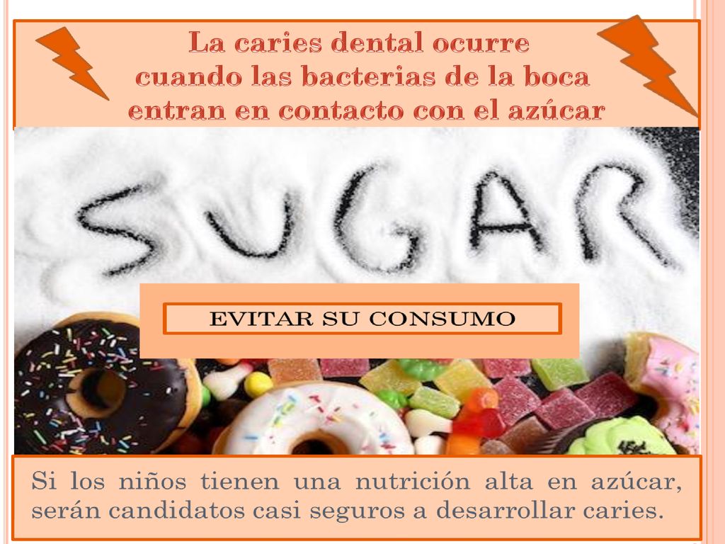 La caries dental ocurre cuando las bacterias de la boca entran en contacto con el azúcar