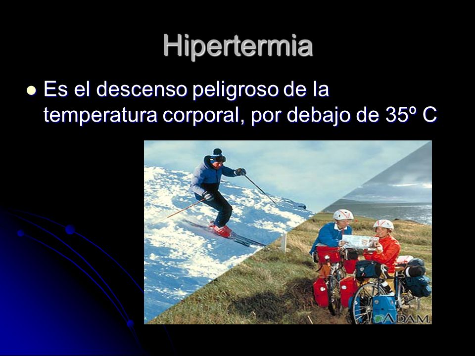 Hipertermia Es el descenso peligroso de la temperatura corporal, por debajo de 35º C