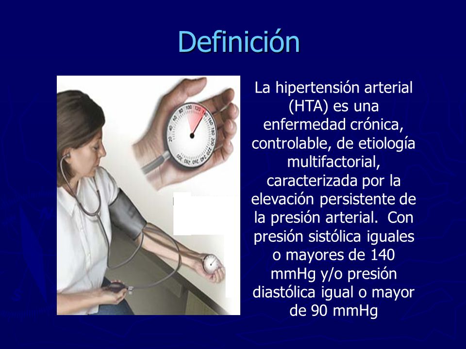 Definición