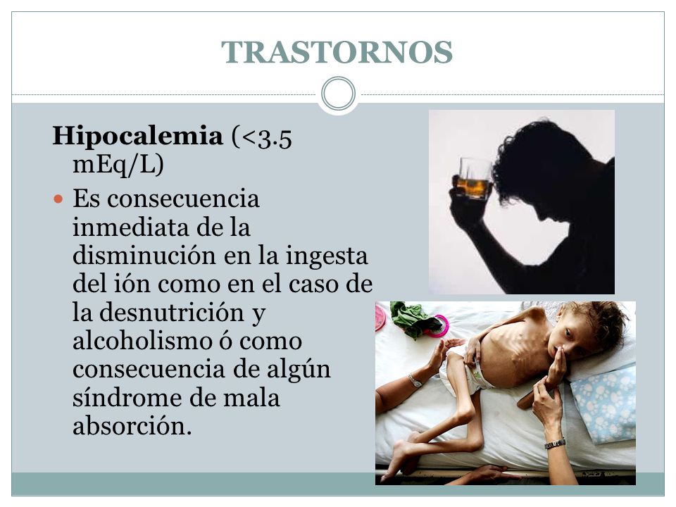 TRASTORNOS Hipocalemia (<3.5 mEq/L)