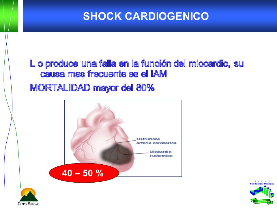 SHOCK CARDIOGENICO L o produce una falla en la función del miocardio, su causa mas frecuente es el IAM MORTALIDAD mayor del 80%