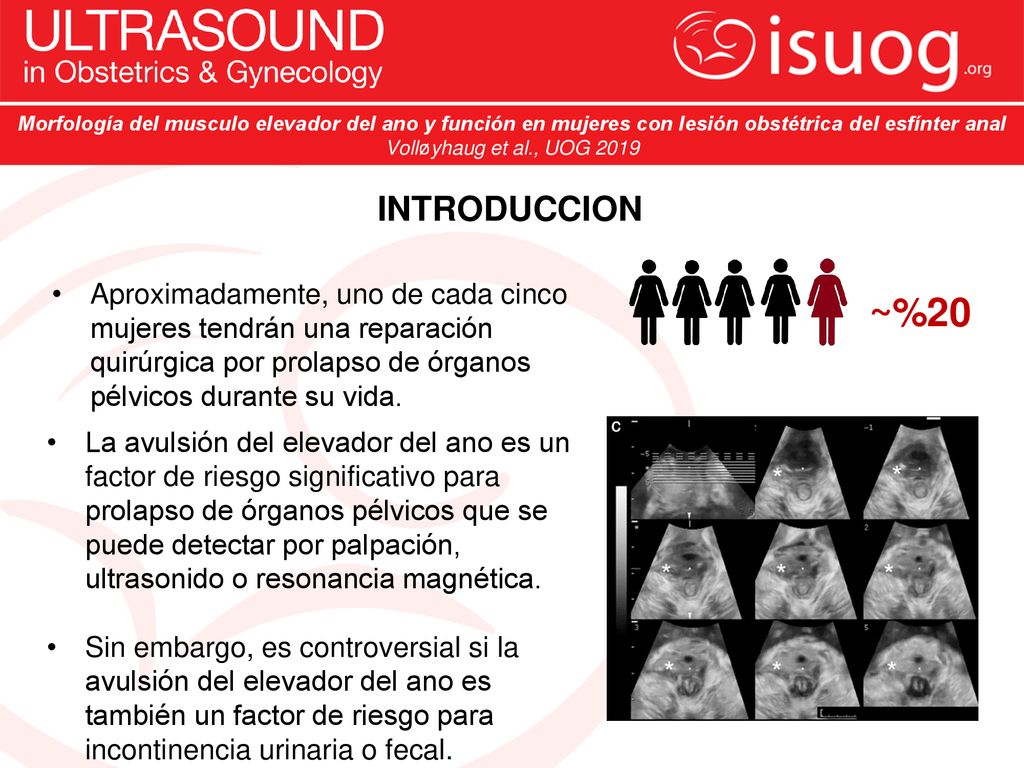 Morfología del musculo elevador del ano y función en mujeres con lesión obstétrica del esfínter anal
