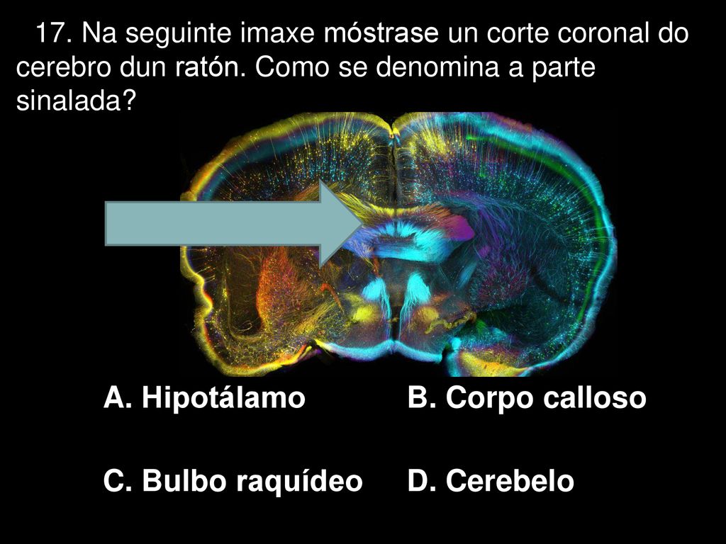 A. Hipotálamo B. Corpo calloso C. Bulbo raquídeo D. Cerebelo