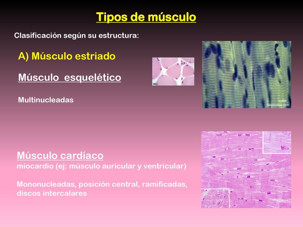 Tipos de músculo A) Músculo estriado Músculo esquelético