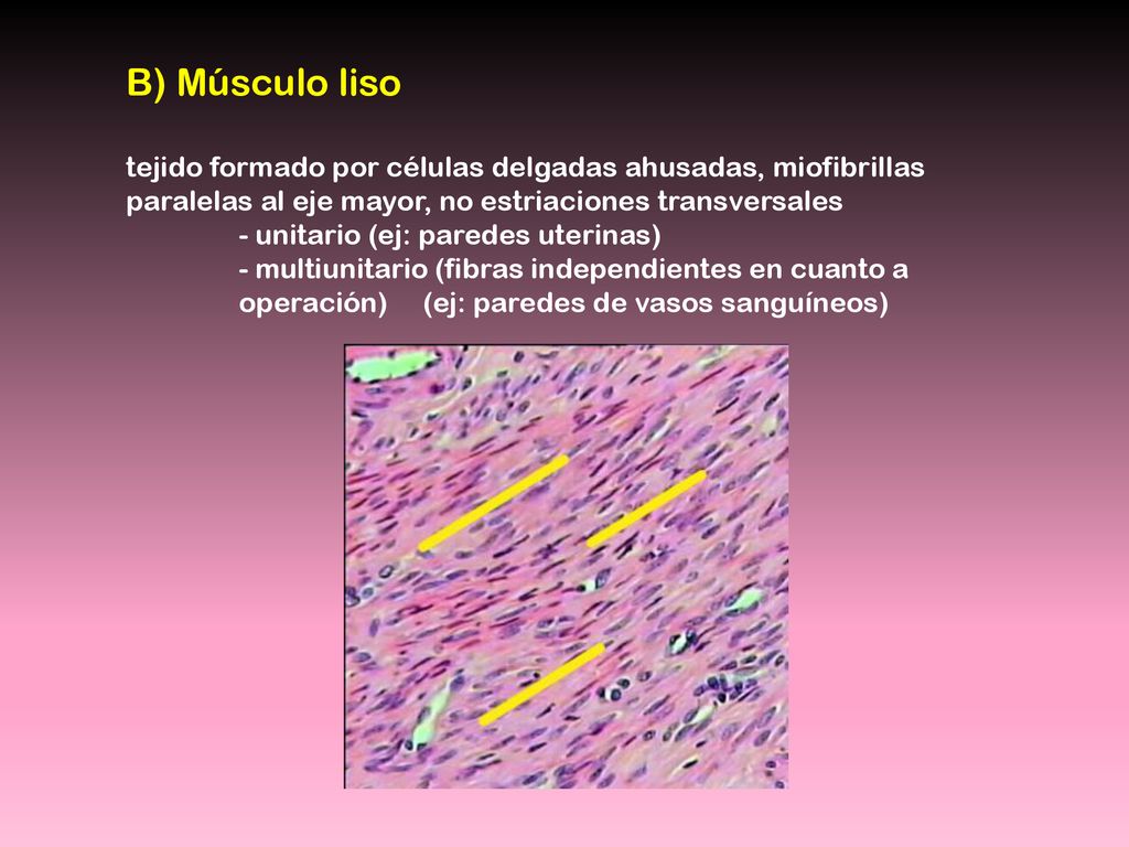 B) Músculo liso tejido formado por células delgadas ahusadas, miofibrillas paralelas al eje mayor, no estriaciones transversales.