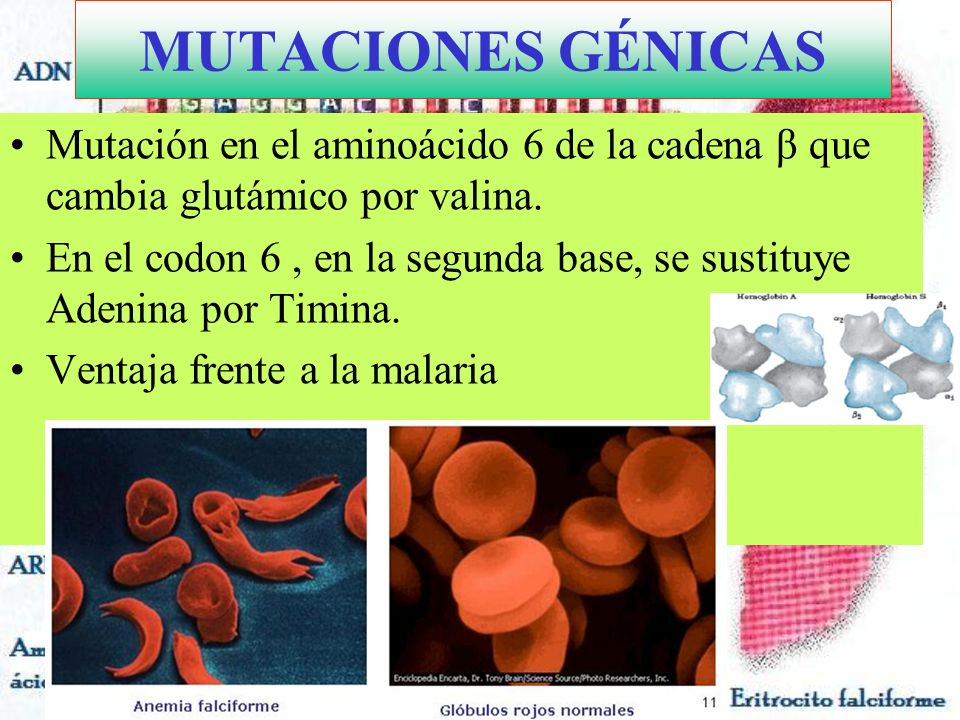 MUTACIONES GÉNICAS Mutación en el aminoácido 6 de la cadena β que cambia glutámico por valina.