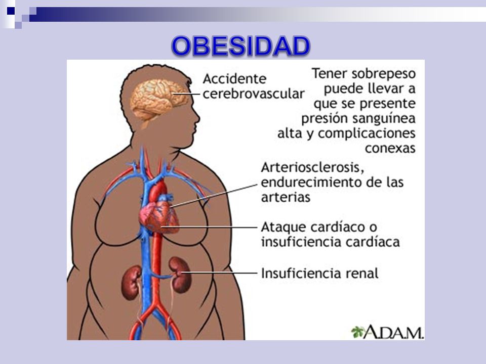 OBESIDAD 5