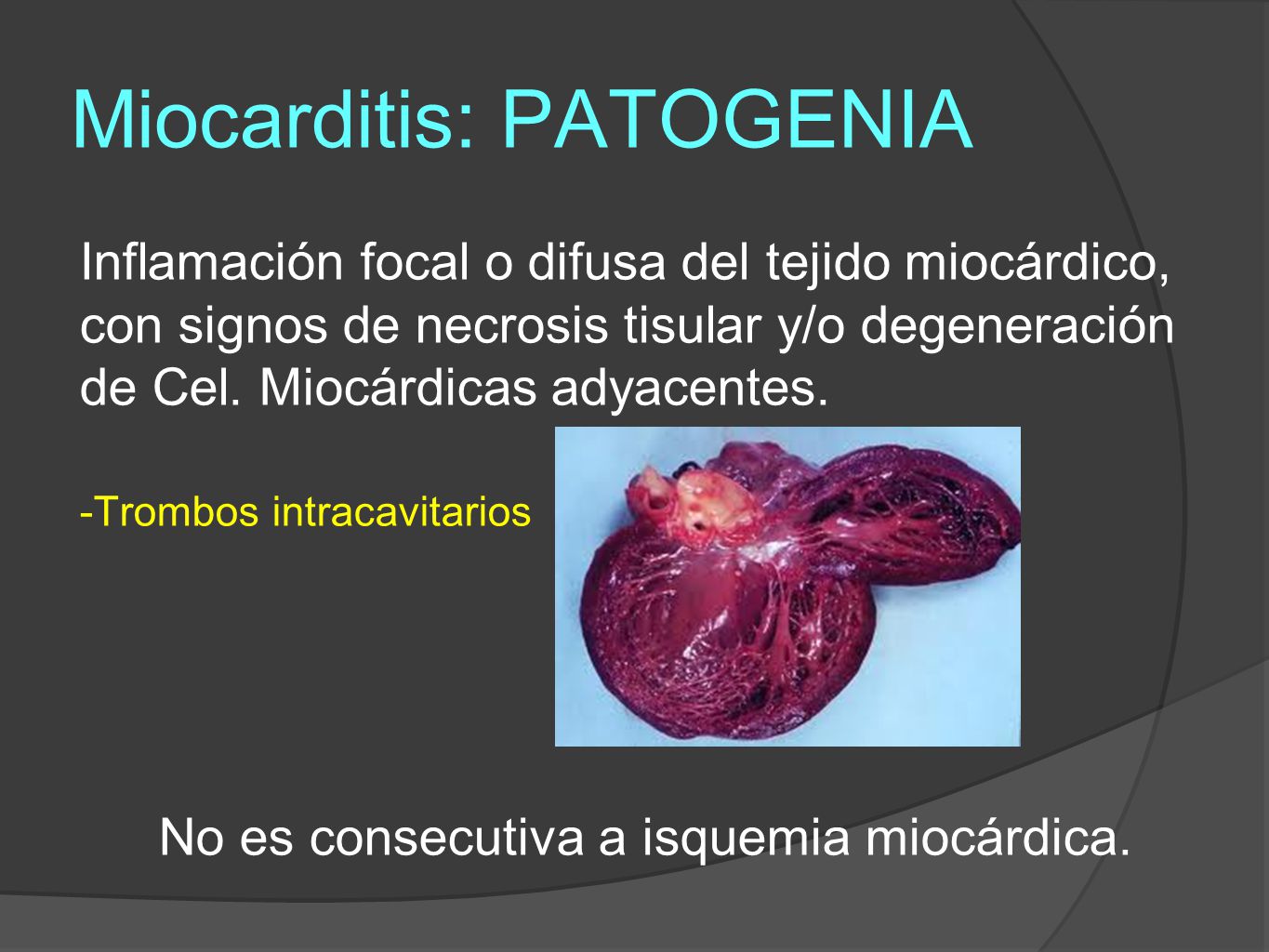Miocarditis Ppt Descargar