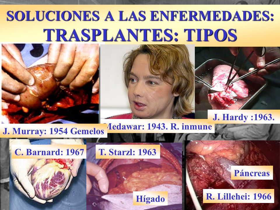 SOLUCIONES A LAS ENFERMEDADES: TRASPLANTES: TIPOS