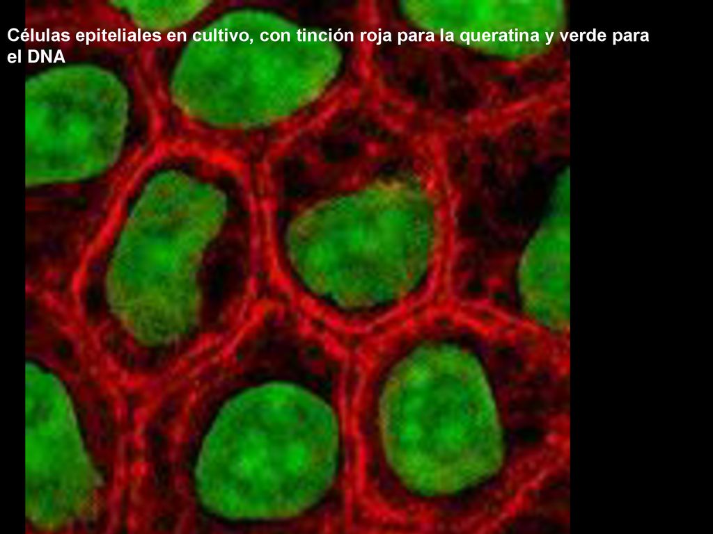 Células epiteliales en cultivo, con tinción roja para la queratina y verde para el DNA