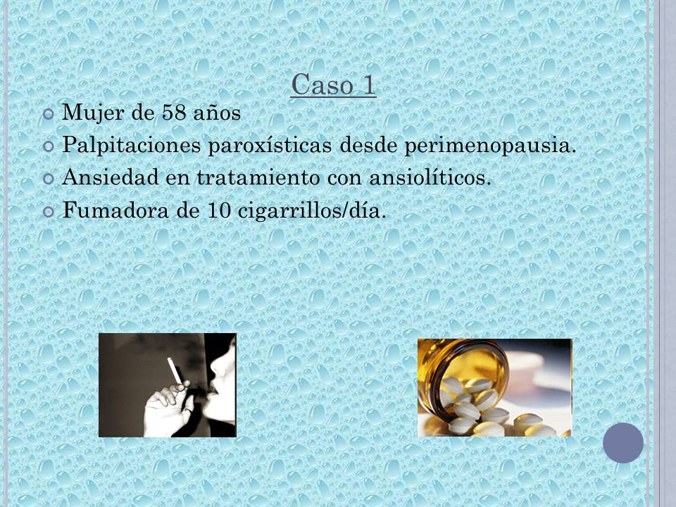Caso 1 Mujer de 58 años. Palpitaciones paroxísticas desde perimenopausia. Ansiedad en tratamiento con ansiolíticos.