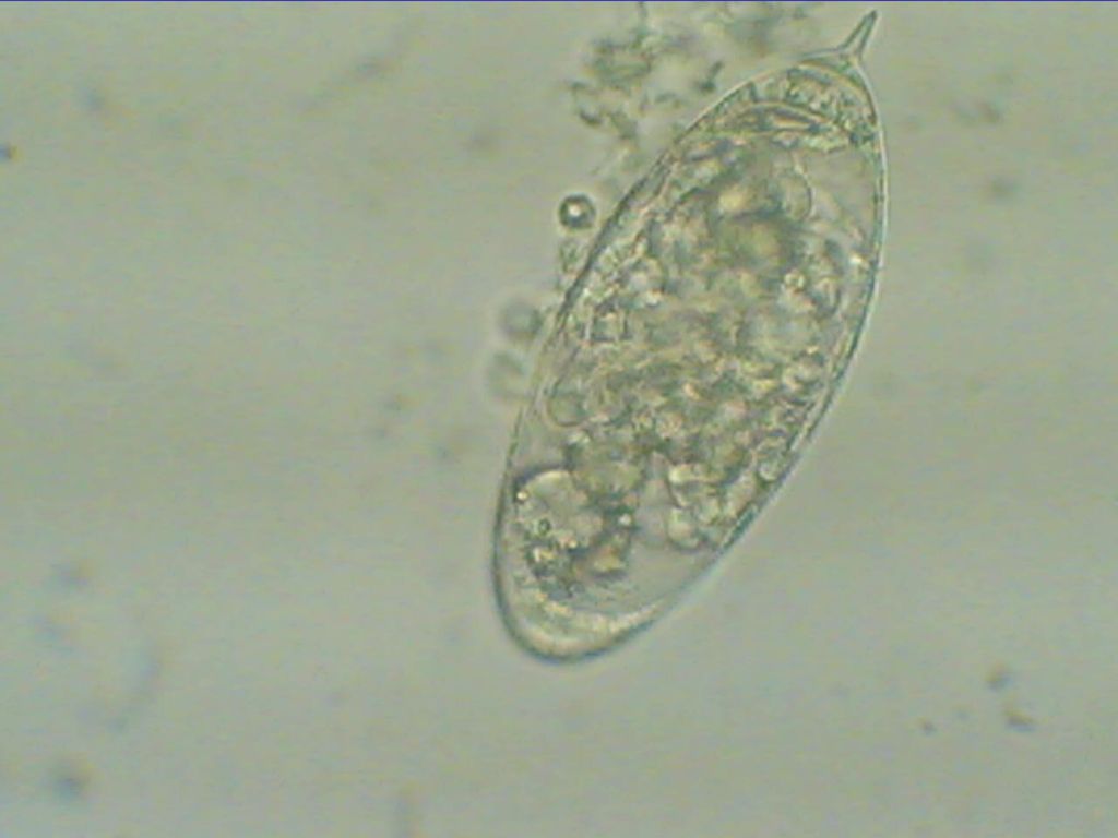 Huevo de Schistosoma haematobium, con su característico espolón en un extremo (el huevo de S.
