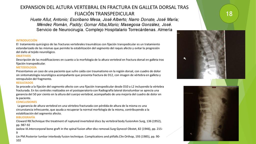 EXPANSION DEL ALTURA VERTEBRAL EN FRACTURA EN GALLETA DORSAL TRAS FIJACIÓN TRANSPEDICULAR Huete Allut, Antonio; Escribano Mesa, José Alberto; Narro Donate, José María; Méndez Román, Paddy; Gomar Alba,Mario; Masegosa González, José. Servicio de Neurocirugía. Complejo Hospitalario Torrecárdenas. Almería