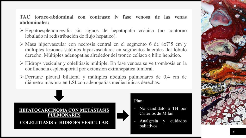 TAC toraco-abdominal con contraste iv fase venosa de las venas abdominales: